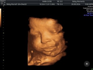 34 WKS baby scan berkshire 